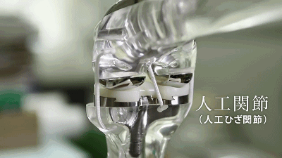 陶瓷人造骨關節(jié)動圖.gif